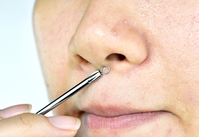 Tips for Blackhead Removal