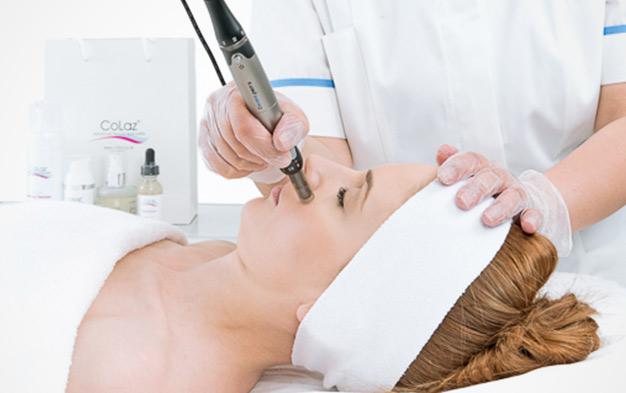 Laser Therapy for Age Spots