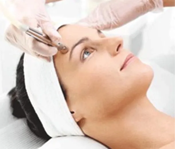 Microdermabrasion 60 Mins 6x sessions