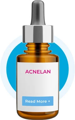 Branded Mesoestetic Acnelan dropper bottle, the in-clinic acne peel system delivered by trained specialists at CoLaz