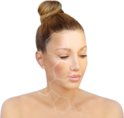 Polynucleotide collagen structure illustrated over a model's face, the regenerative effect at the dermis