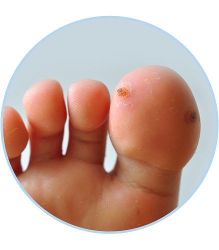CoLaz clinician reviewing the foot at a careful in-clinic consultation