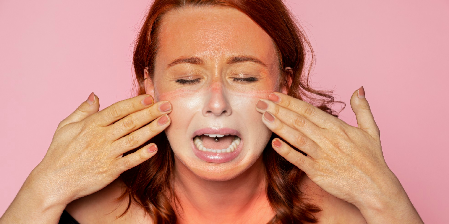 AHA peel side effects on sensitive skin