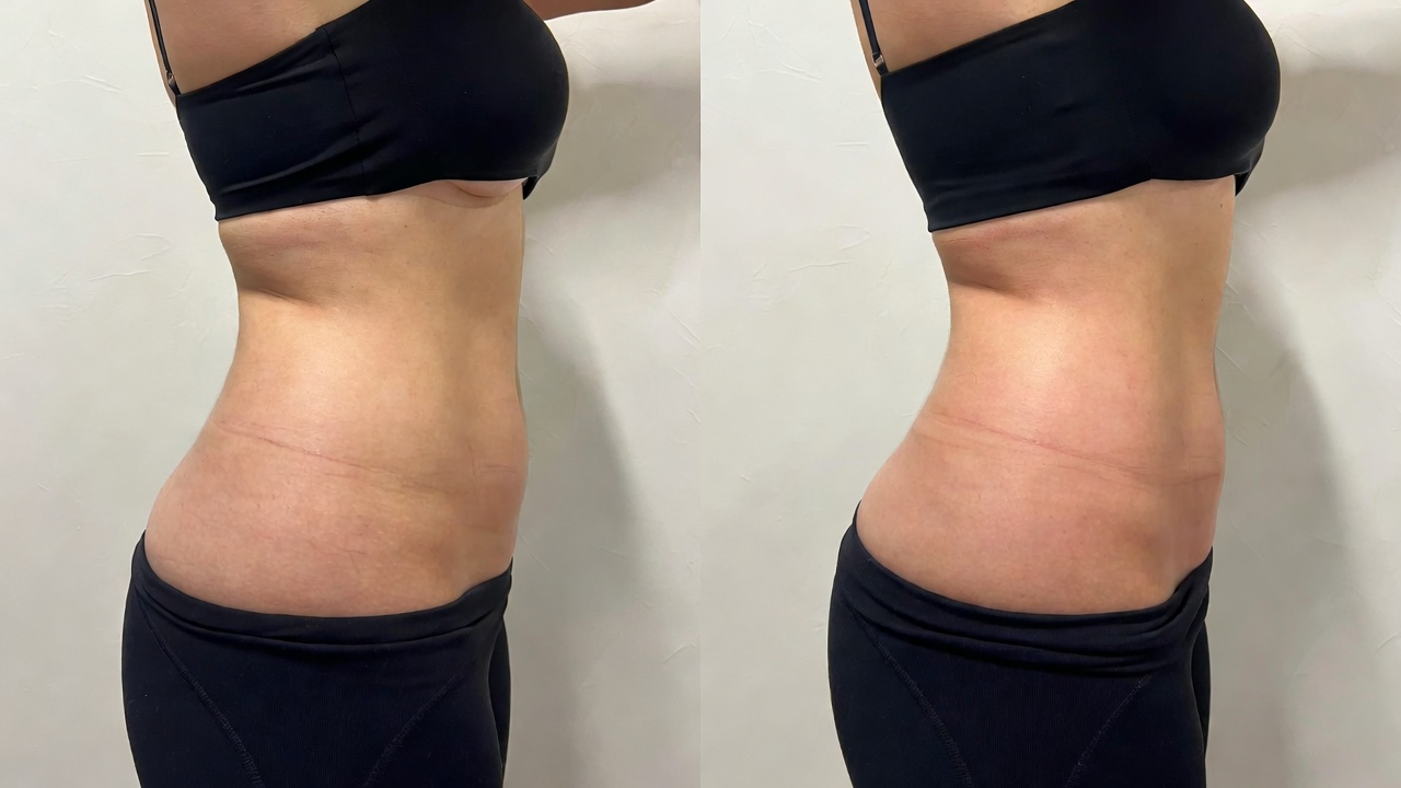 Lemon Bottle for Love Handles: 10 Key Facts You Should Know